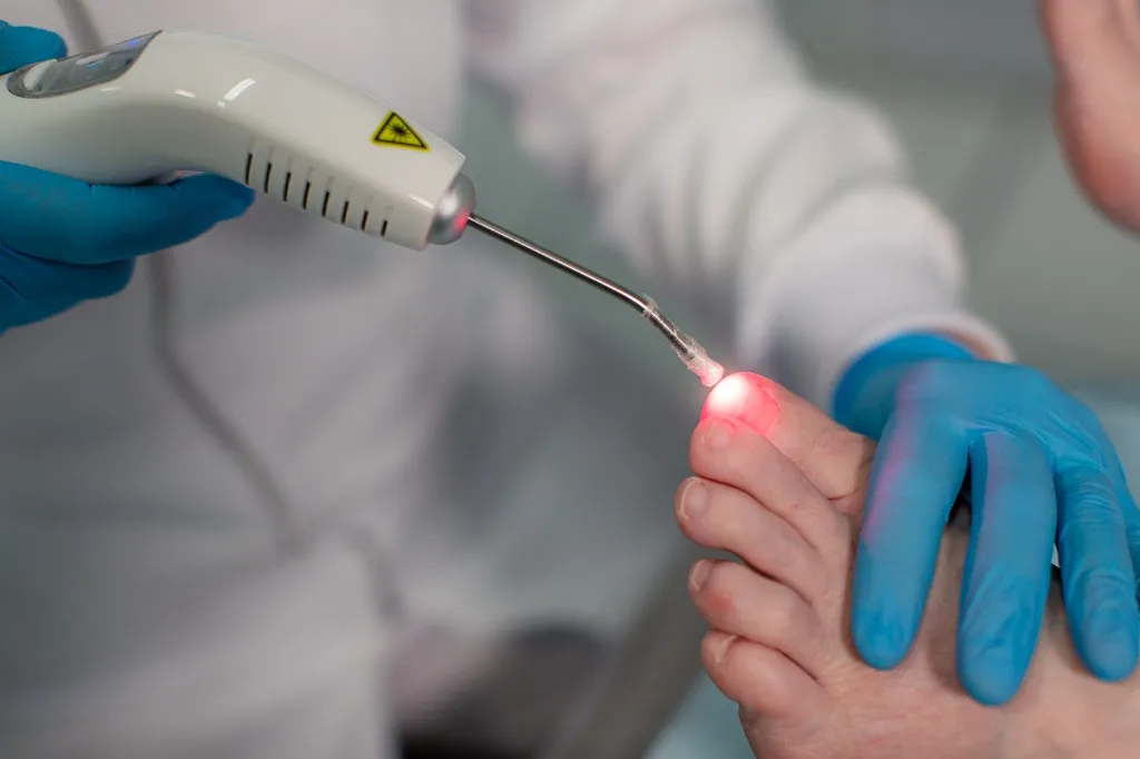 Dispositivo clínico de Laserterapia Sistémica e Método ILIB utilizado para tratamentos de saúde celular
